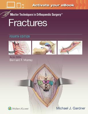 Master Techniques in Orthopaedic Surgery: Fractures 4th edition