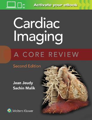 Cardiac Imaging: A Core Review 2nd edition