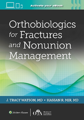 Orthobiologics for Fractures and Nonunion Management