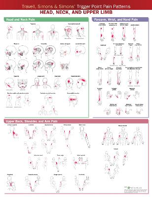 Travell, Simons & Simons Trigger Point Pain Patterns Wall Chart: Head, Neck, and Upper Limb 2nd edition