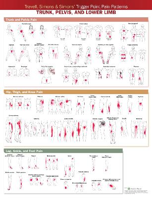 Travell, Simons & Simons Trigger Point Pain Patterns Wall Chart: Trunk, Pelvis, and Lower Limb 2nd edition