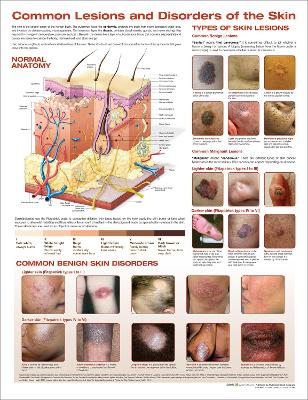 Common Lesions and Disorders of the Skin Anatomical Chart 3rd edition