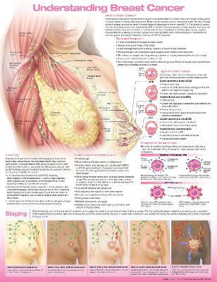 Understanding Breast Cancer Anatomical Chart 4th edition