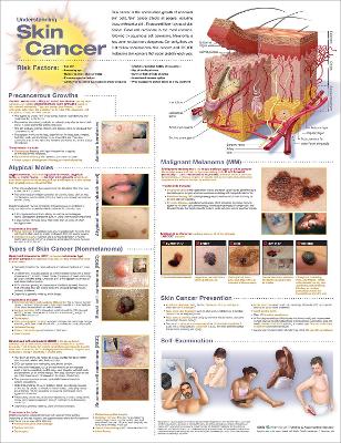 Understanding Skin Cancer Anatomical Chart 3rd edition