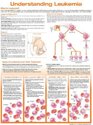 Understanding Leukemia Anatomical Chart 2nd edition