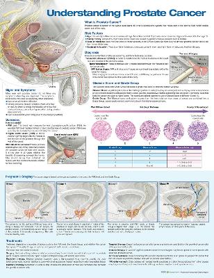 Understanding Prostate Cancer Anatomical Chart 3rd edition