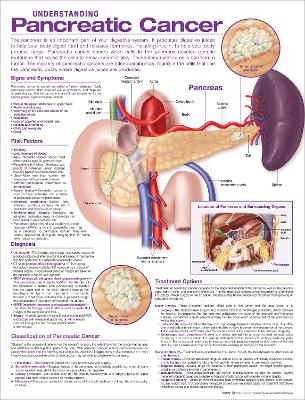 Understanding Pancreatic Cancer Anatomical Chart 2nd edition
