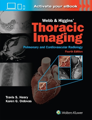 Webb & Higgins Thoracic Imaging: eBook with Multimedia