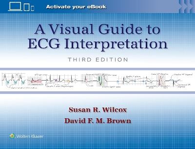 Visual Guide to ECG Interpretation: Print plus eBook with Multimedia 3rd edition