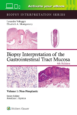Biopsy Interpretation of the Gastrointestinal Tract Mucosa Volume 1: Non-Neoplastic: Print plus eBook with Multimedia 4th edition