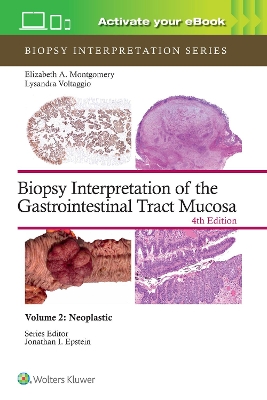 Biopsy Interpretation of the Gastrointestinal Tract Mucosa Volume 2: Neoplastic: Print plus eBook with Multimedia 4th edition