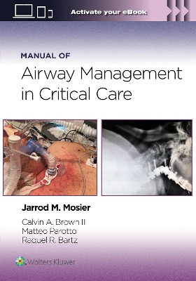 Manual of Airway Management in Critical Care: Print plus eBook with Multimedia