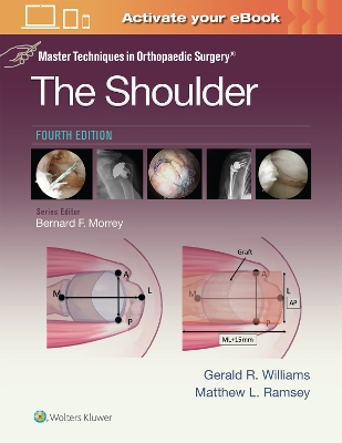 Master Techniques in Orthopaedic Surgery: The Shoulder: Print plus eBook with  Multimedia 4th edition