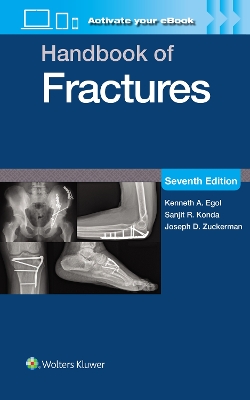 Handbook of Fractures: Print plus eBook with Multimedia 7th edition