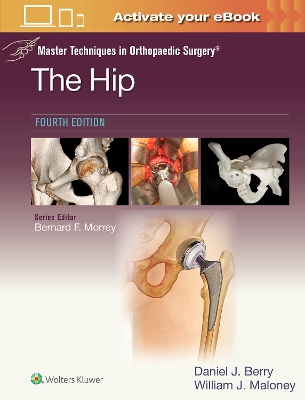 Master Techniques in Orthopaedic Surgery: The Hip: Print plus eBook with  Multimedia 4th edition