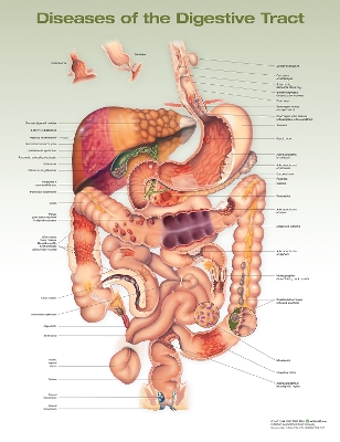 Diseases of the Digestive Tract Anatomical Chart 2nd edition