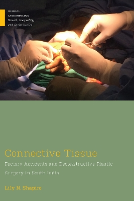 Connective Tissue: Factory Accidents and Reconstructive Plastic Surgery in South India