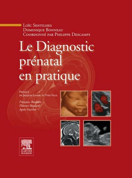 Le Diagnostic prÃ©natal en pratique