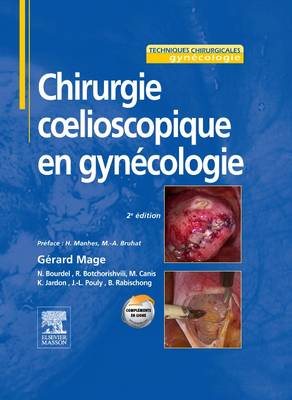 Chirurgie cÅ“lioscopique en gynÃ©cologie