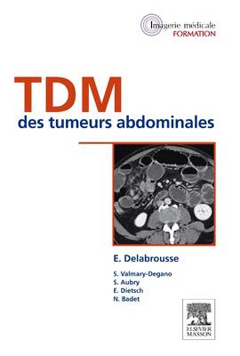 TDM des tumeurs abdominales