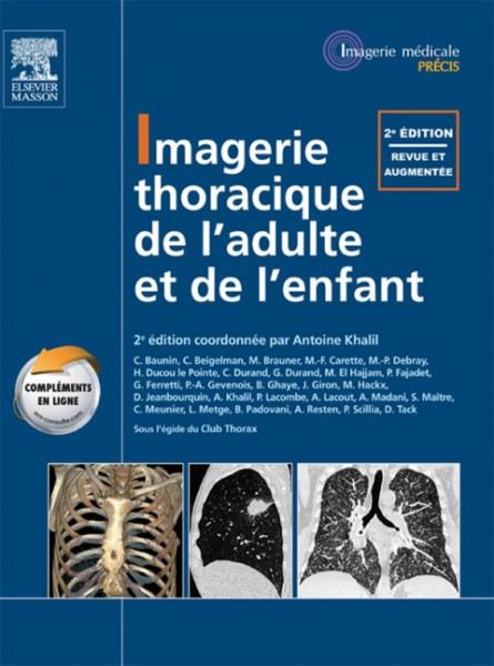 Imagerie thoracique de l''enfant et de l''adulte
