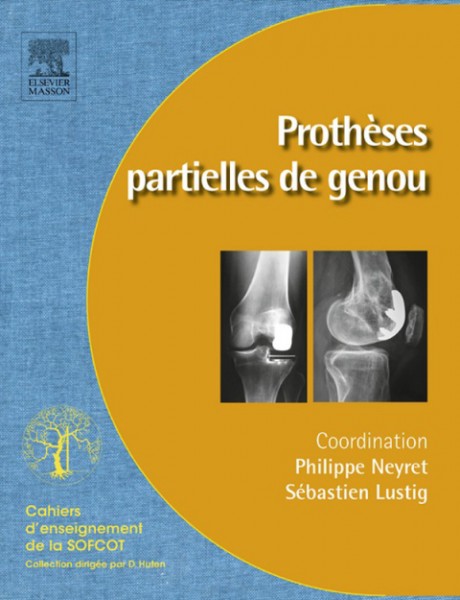 ProthÃ¨ses partielles du genou: Protheses unicompartimentaires et femoropatellaires