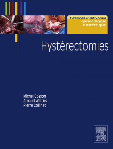 HystÃ©rectomies