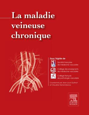 La maladie veineuse chronique