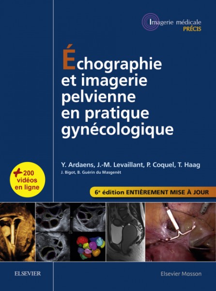 Ã‰chographie et imagerie pelvienne en pratique gynÃ©cologique