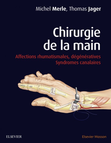 Chirurgie de la main: Affections rhumatismales, degeneratives. Syndromes canalaires