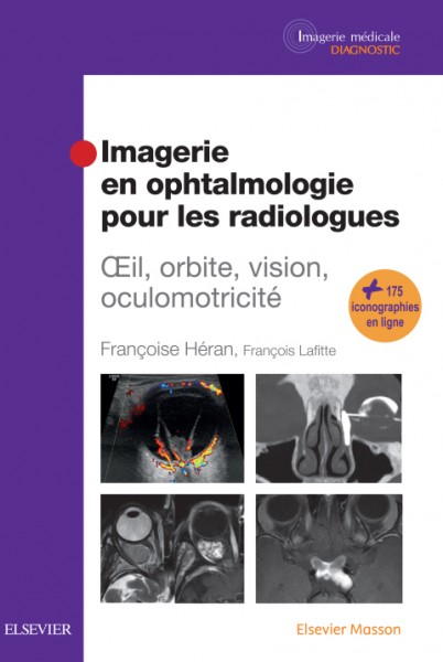 Imagerie en ophtalmologie pour les radiologues: Oeil, orbite, vision, oculomotricite