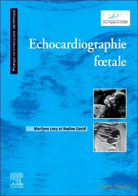 Echocardiographie fÅ“tale