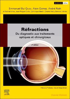 RÃ©fractions: Du diagnostic aux traitements optiques et chirurgicaux