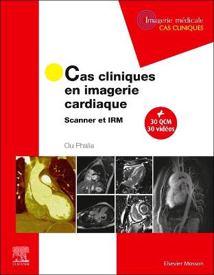 Cas cliniques en imagerie cardiaque: Scanner et IRM