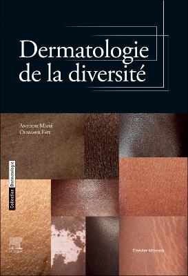 Dermatologie de la diversitÃ©
