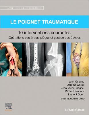 Le poignet traumatique 10 interventions courantes: Manuel de chirurgie du membre superieur