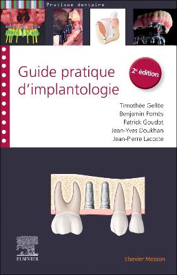 Guide pratique d''implantologie