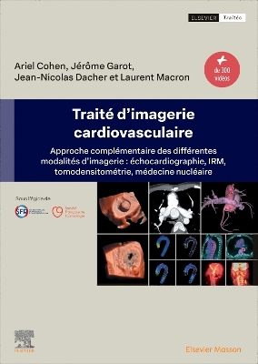 TraitÃ© d''imagerie cardiovasculaire: Approche complementaire des differentes modalites d'imagerie : echocardiographie, IRM, tomodensitometrie, medecine nucleaire