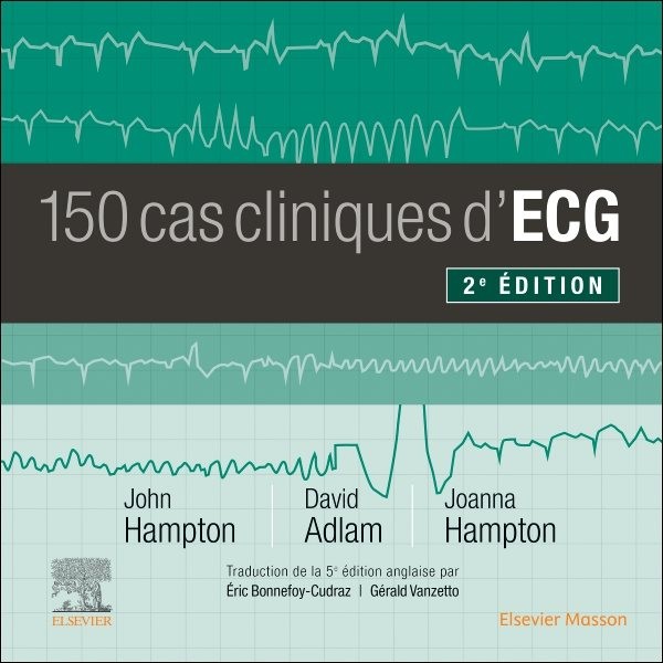 150 cas cliniques d'ECG 2nd edition