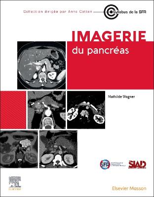 Imagerie du pancrÃ©as
