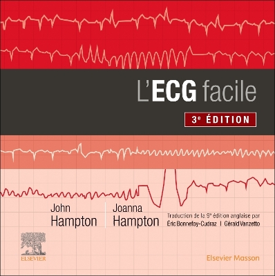 L''ECG facile