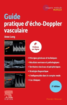 Guide pratique d''Ã©cho-Doppler vasculaire