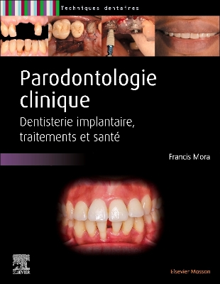 Parodontologie clinique: Dentisterie implantaire, traitements et santé