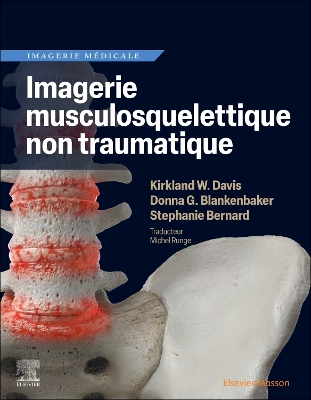 Imagerie musculosquelettique non traumatique