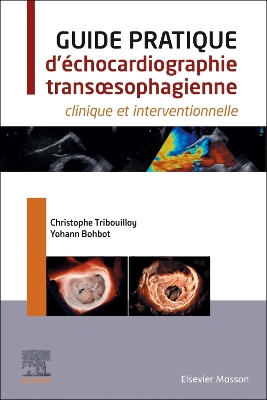 Guide pratique d''Ã©chocardiographie transÅ“sophagienne: clinique et interventionnelle