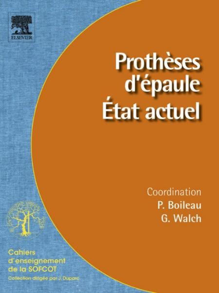 ProthÃ¨ses d''Ã©paule. Ã‰tat actuel