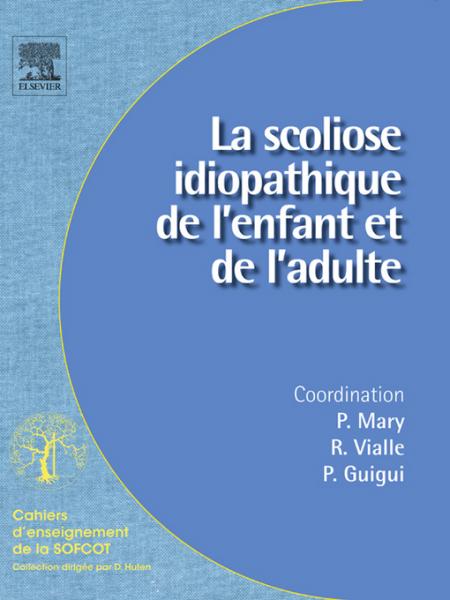 La scoliose idiopathique de l''enfant et de l''adulte