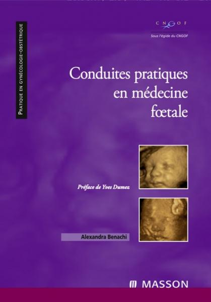 Conduites pratiques en mÃ©decine foetale