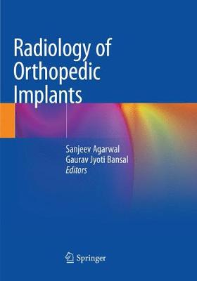Radiology of Orthopedic Implants Softcover Reprint of the Original 1st 2018 ed.