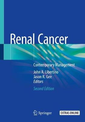 Renal Cancer: Contemporary Management Second Edition 2020